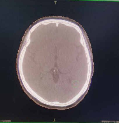 放左边.png 放左边.png