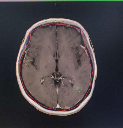 放右边.png 放右边.png