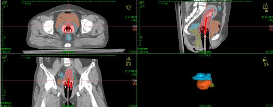 20200325061828_26766.jpeg 20200325061828_26766.jpeg